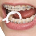 The Importance of Good Oral Hygiene: Tips from a Dental Expert